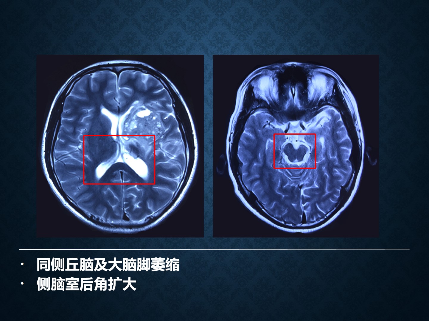 幻灯片6.jpg