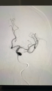 4.gif