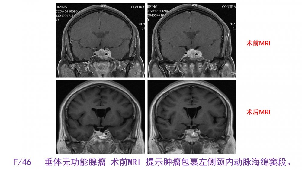 幻灯片2.jpg