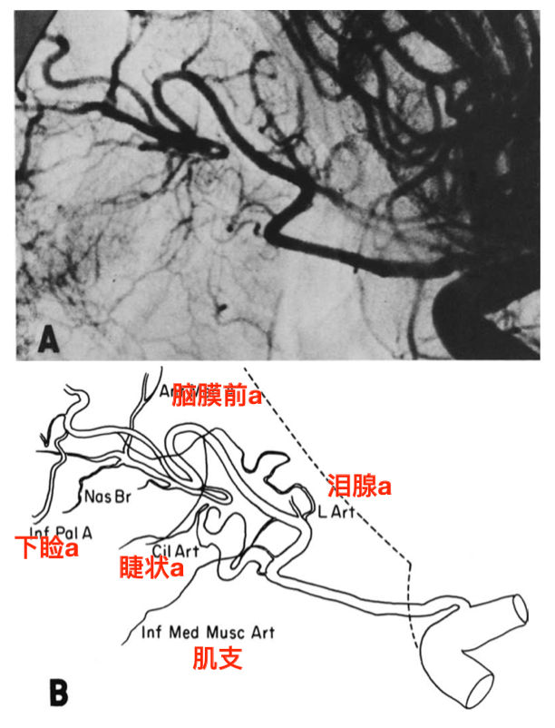 脑血管解剖学习笔记第43期眼动脉大体解剖