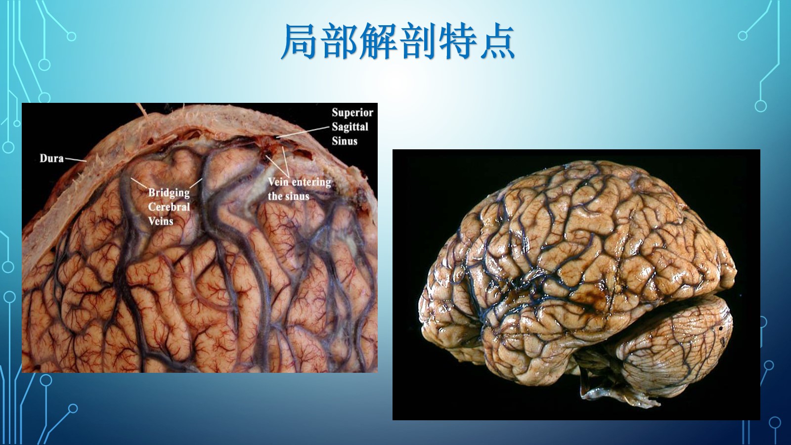 头颅CT示:左基底节区软化灶 - 病例中心(诊疗助手) - 爱爱医医学网