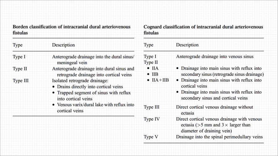 硬脑膜动静脉瘘的介入治疗_09.png