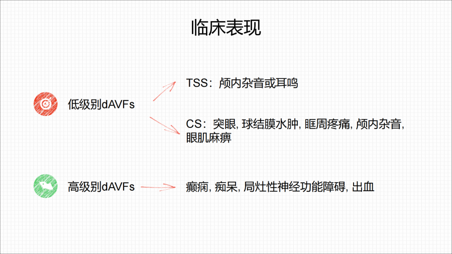 硬脑膜动静脉瘘的介入治疗_08.png