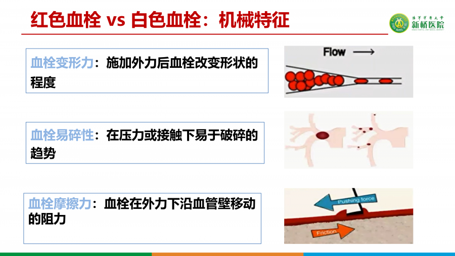 如何精准选择支架取栓术或ADAPT技术_04.png