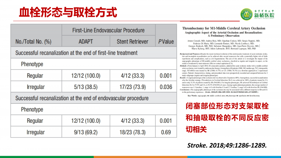 如何精准选择支架取栓术或ADAPT技术_21.png