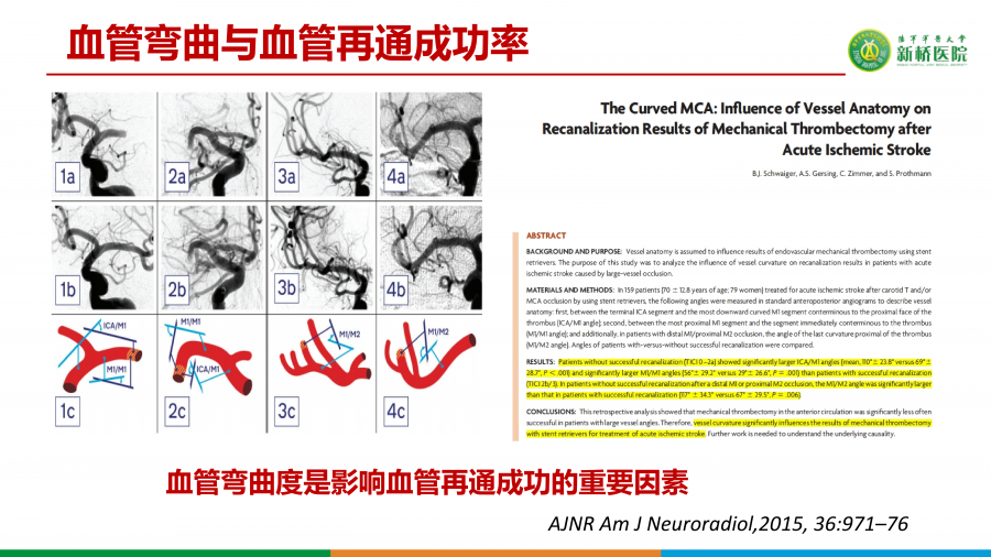 如何精准选择支架取栓术或ADAPT技术_24.png