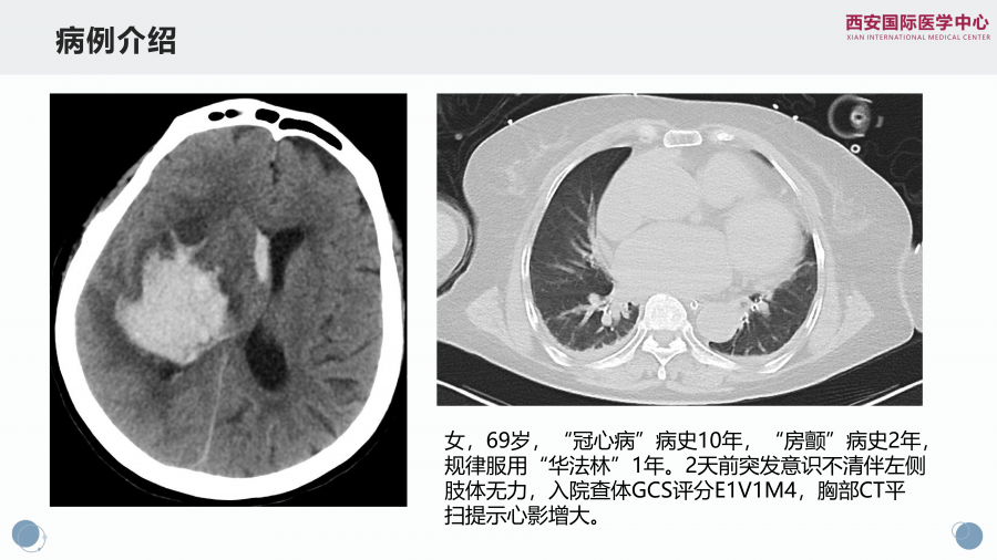 脑出血合并心衰一例谈目标导向液体治疗策略_01.png