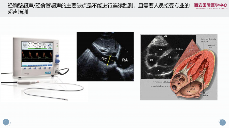 脑出血合并心衰一例谈目标导向液体治疗策略_11.png