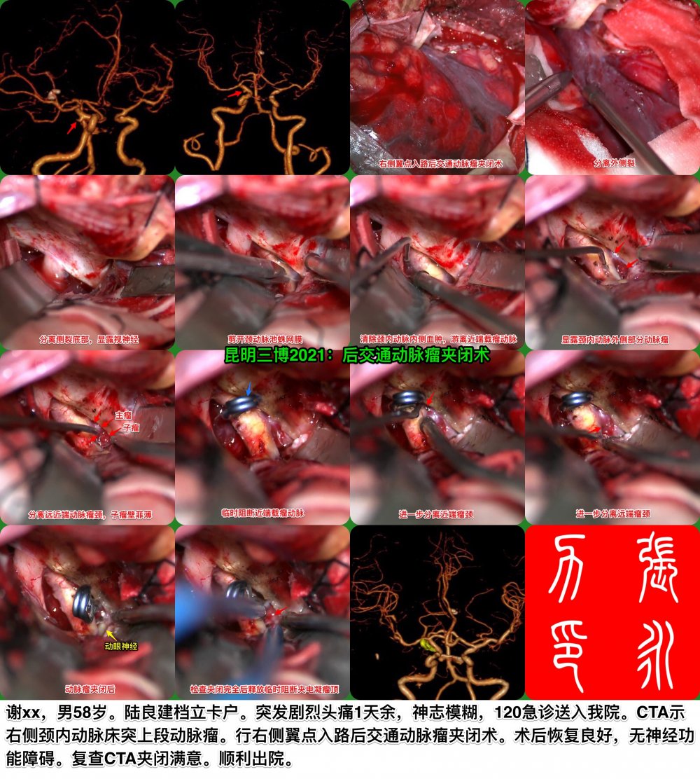 动脉瘤假币书.jpg