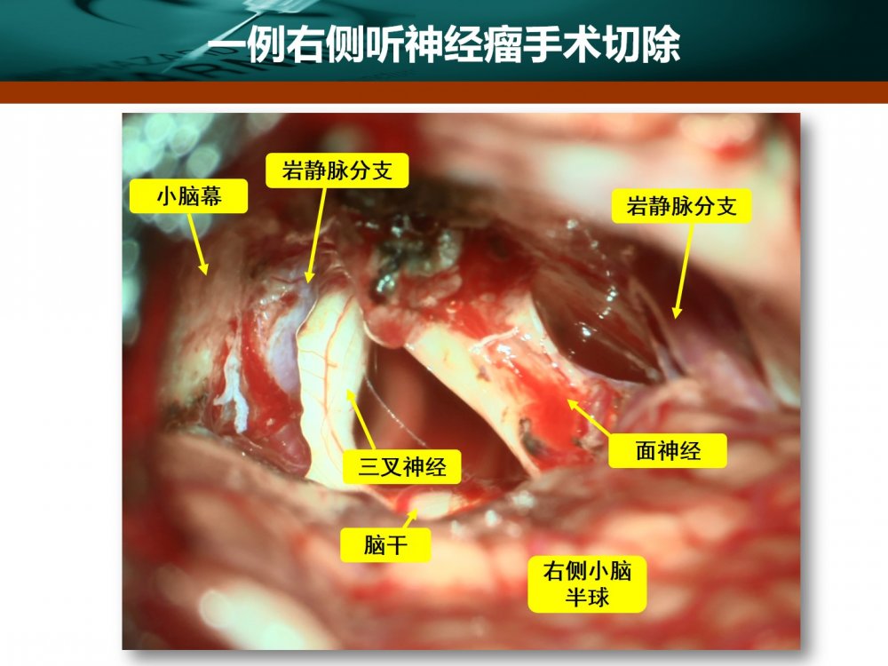 幻灯片10.jpg