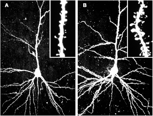 点,着重研究了大脑最具有可塑性的部位——树突棘的性质和重塑过程