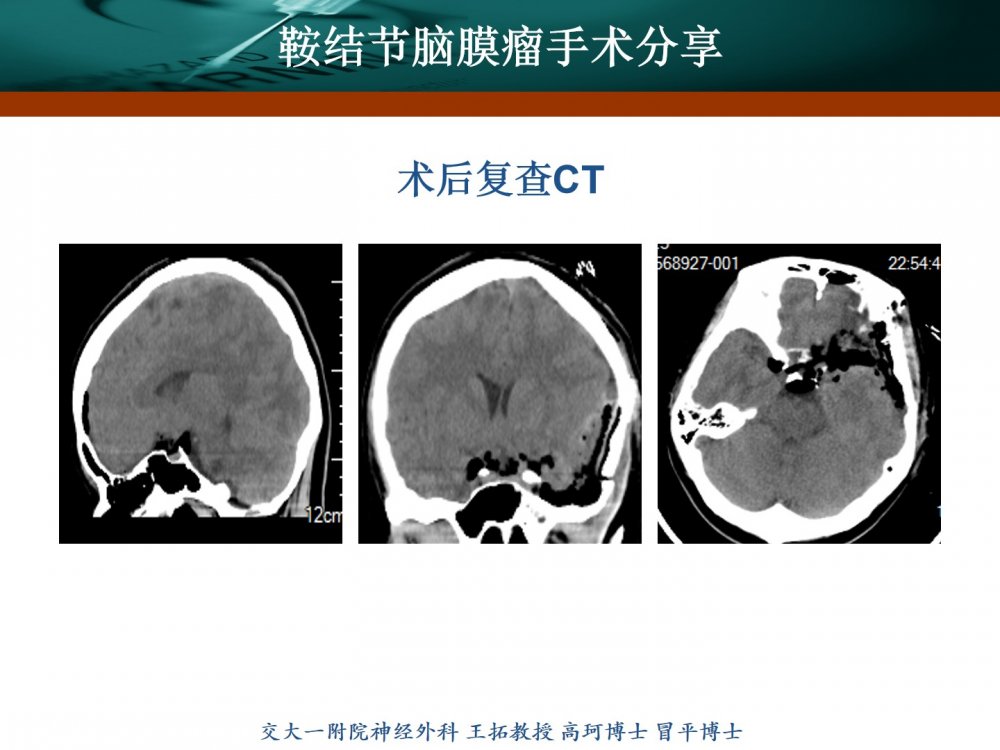 幻灯片11.jpg