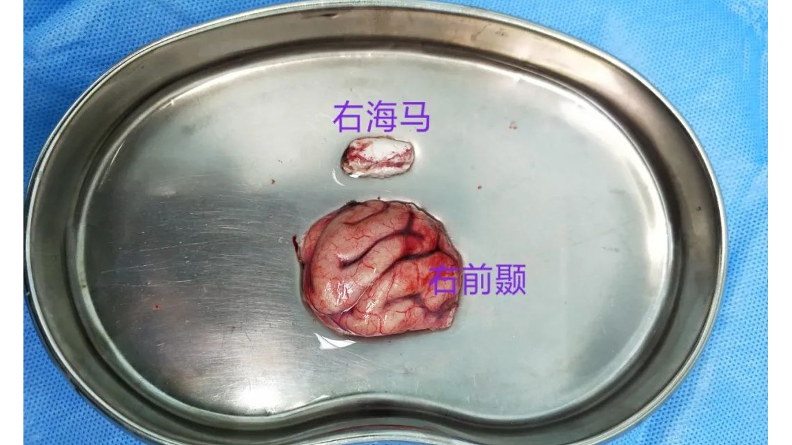 20210624120011_quyw22bxuv.png