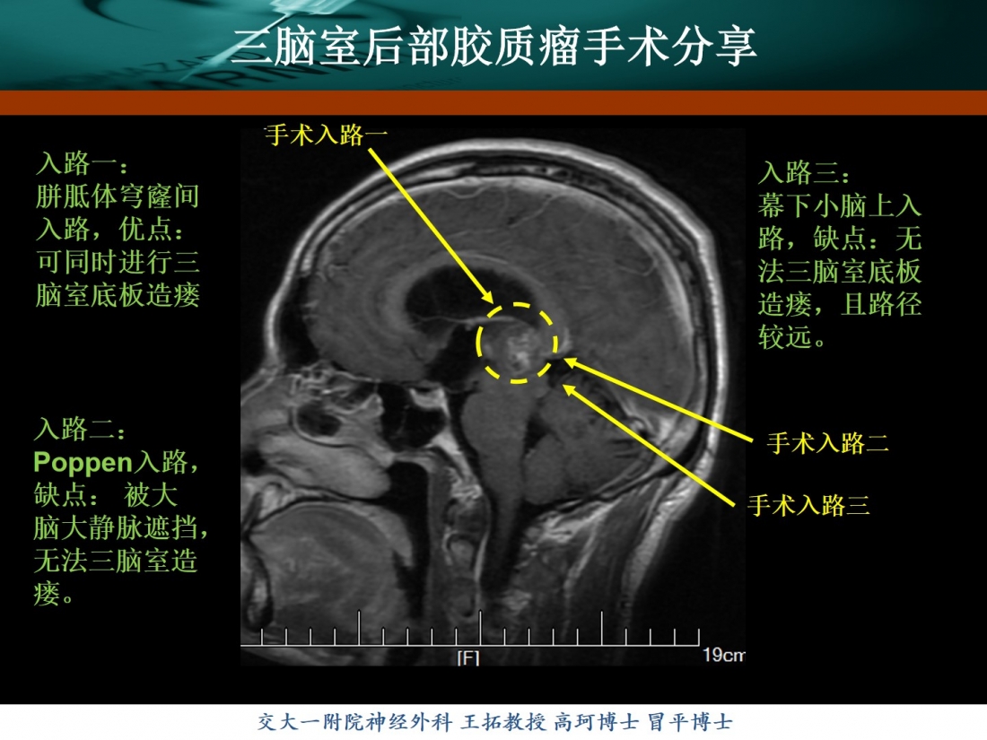 幻灯片4.jpg