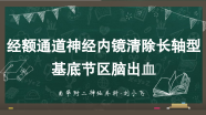 经额通道神经内镜清除长轴型基底节区脑出血1例